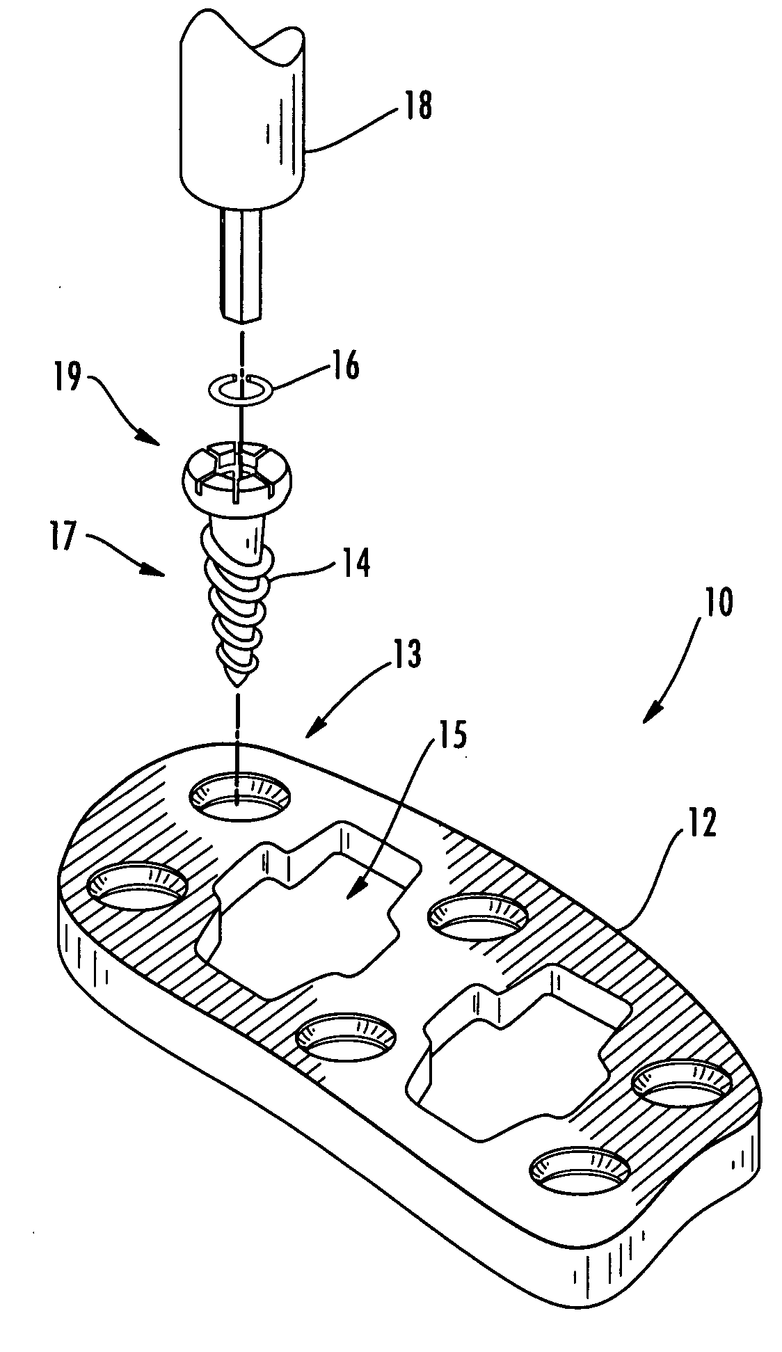 Cervical plate locking mechanism and associated surgical method