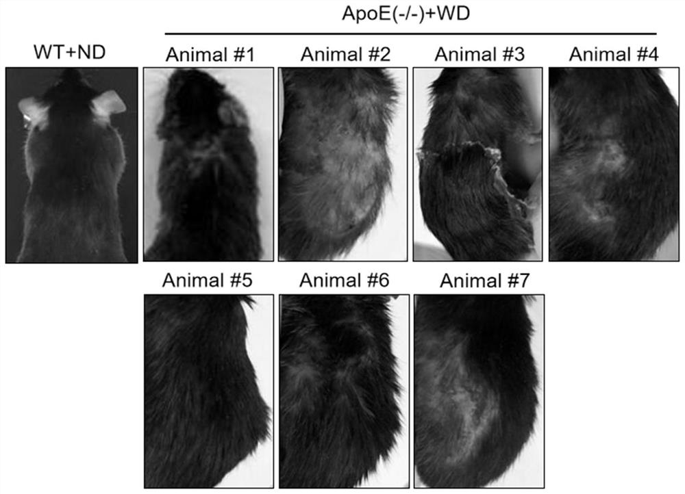 Use of nitazoxanide and in-vivo metabolite tizoxanide thereof in resisting psoriasis and psoriasis-like dermatitis