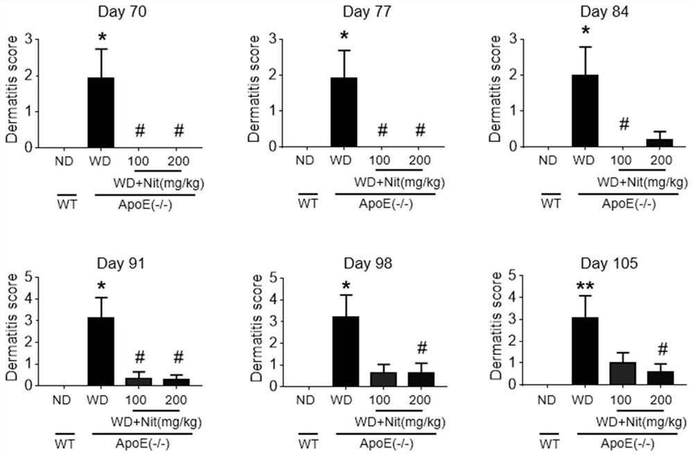 Use of nitazoxanide and in-vivo metabolite tizoxanide thereof in resisting psoriasis and psoriasis-like dermatitis