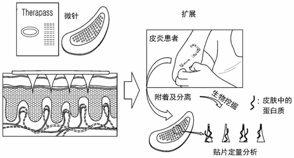 Minimally invasive skin biopsy method using microneedle patch