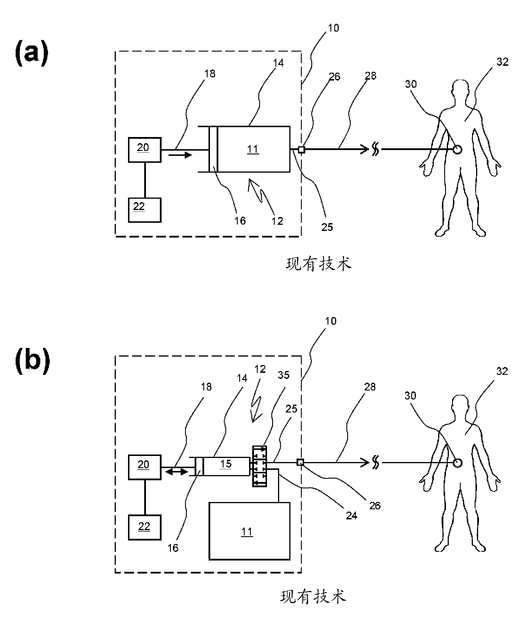 Infusion pump device with cylinder-piston dosing unit and optical piston position detection