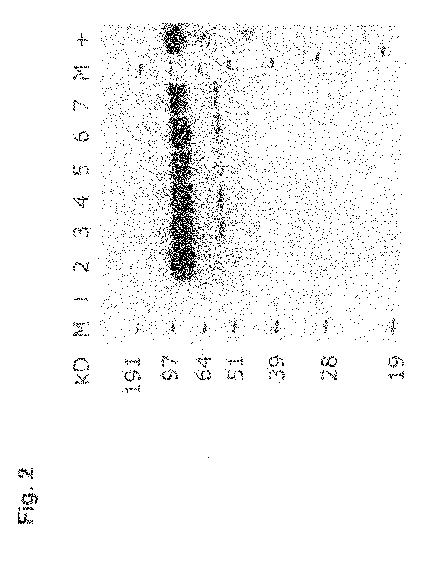 Transient protein expression methods