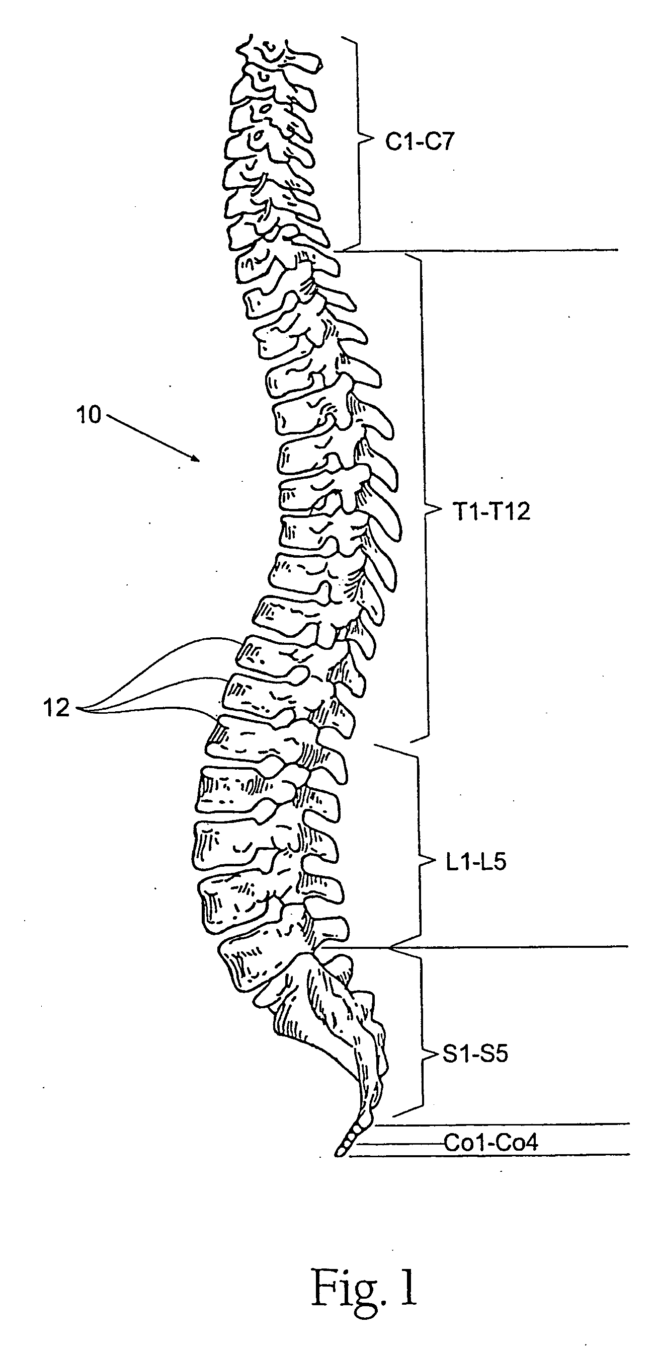 Facet joint prosthesis measurement and implant tools