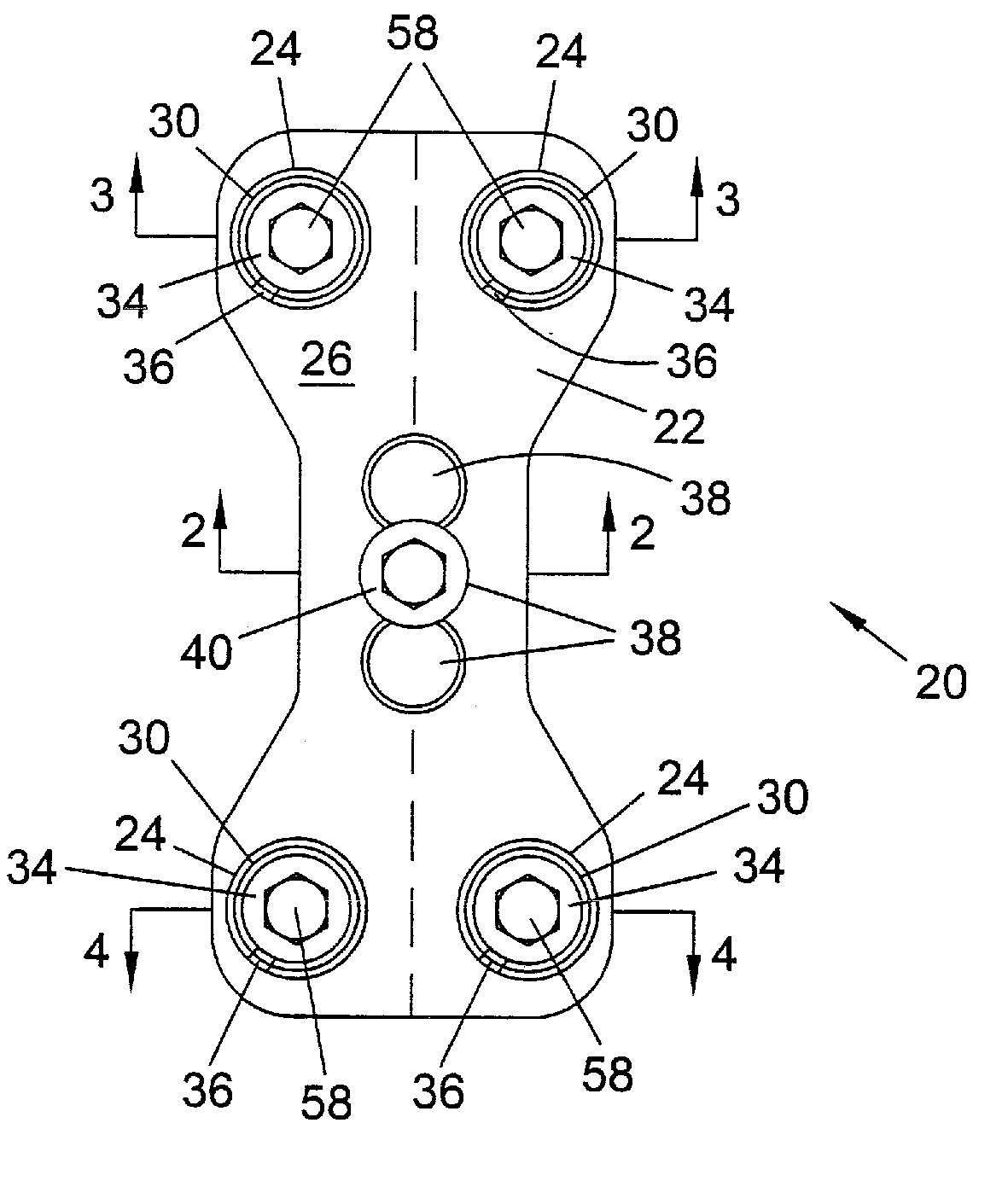 System and method for stabilizing the human spine with a bone plate