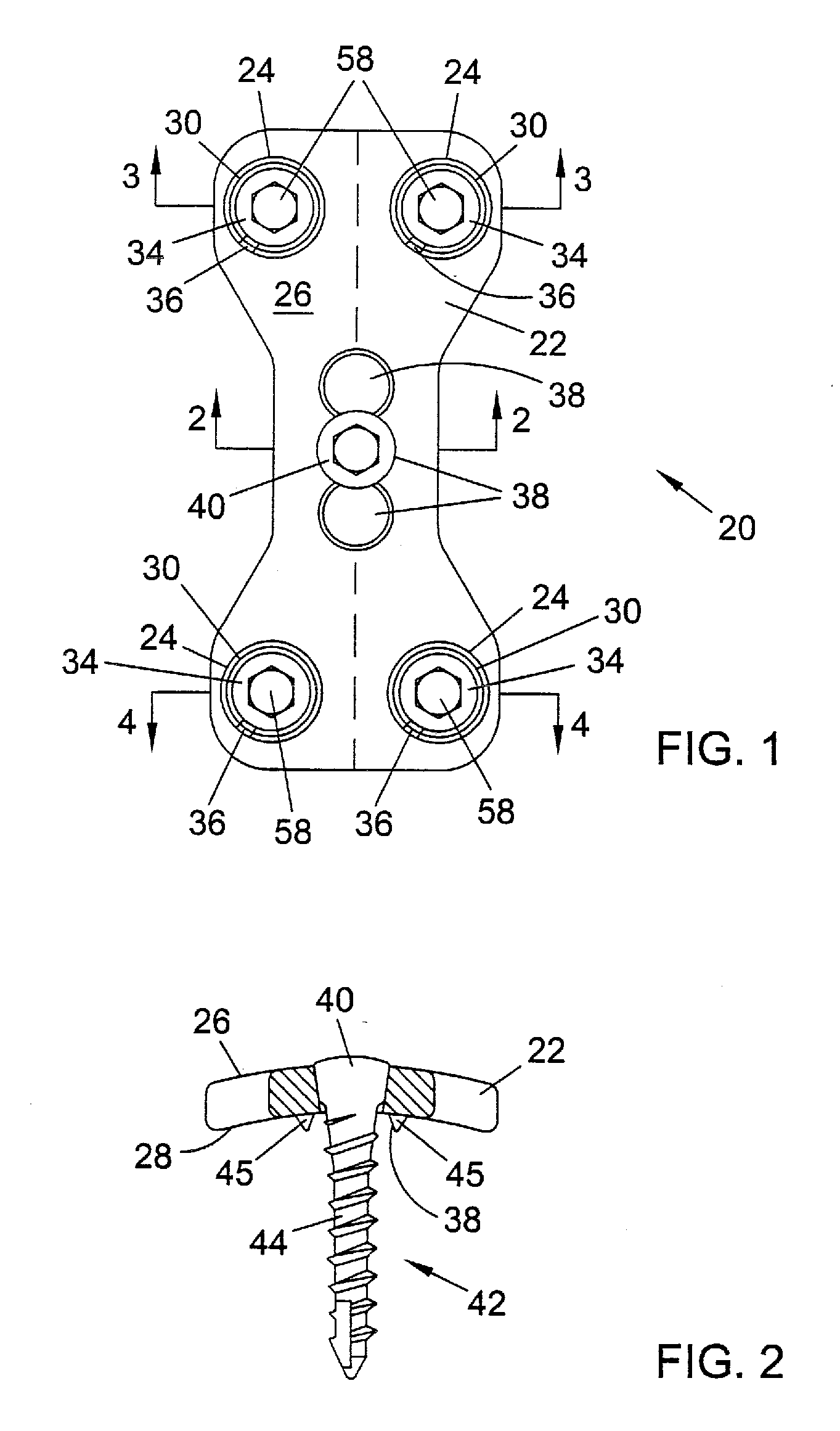 System and method for stabilizing the human spine with a bone plate