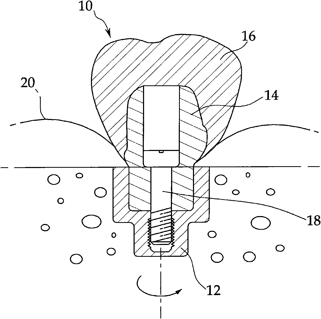 Dental implant abutment blank for tailor-made dental abutments and method for manufacturing a dental abutment using the same