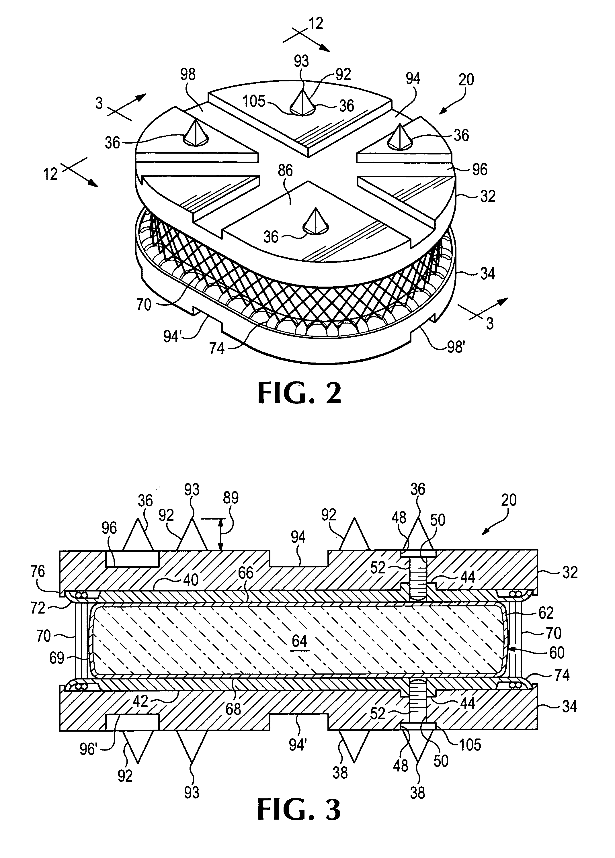 Anatomic total disc replacement