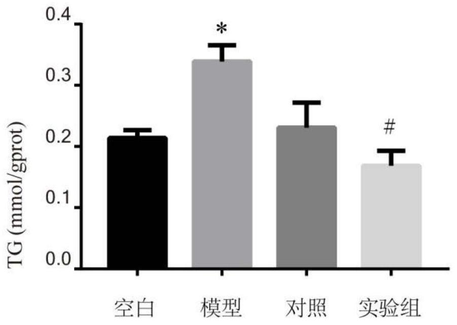 Application of aescin in treatment of non-alcoholic fatty liver diseases