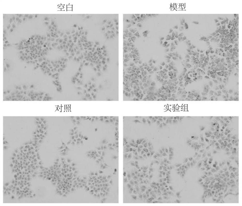 Application of aescin in treatment of non-alcoholic fatty liver diseases