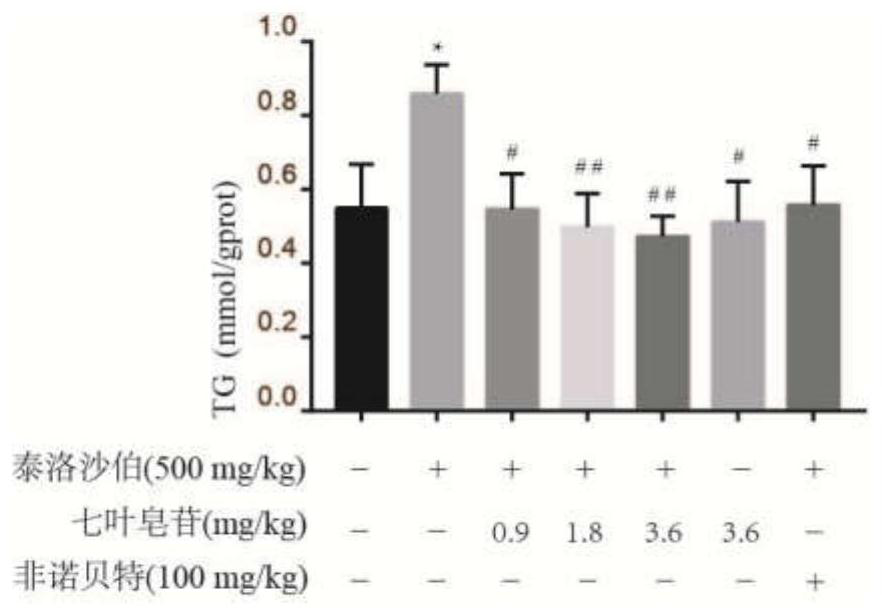 Application of aescin in treatment of non-alcoholic fatty liver diseases