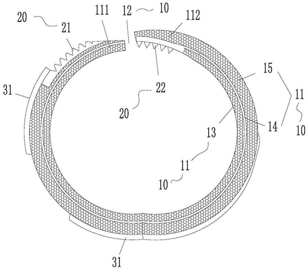 Intramedullary fusion part and femoral prosthesis assembly with same