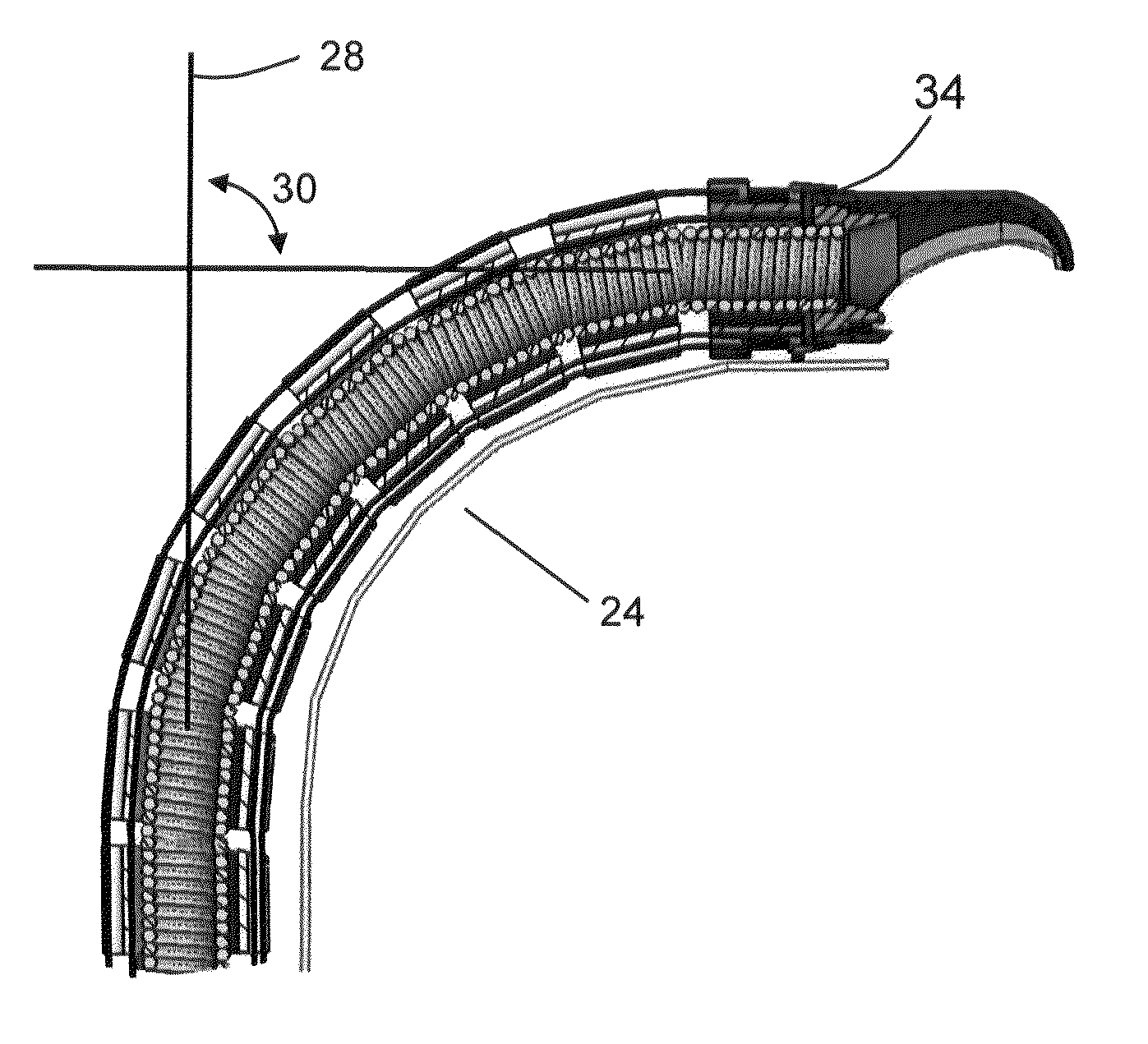 Apparatus and methods for removal of intervertebral disc tissues