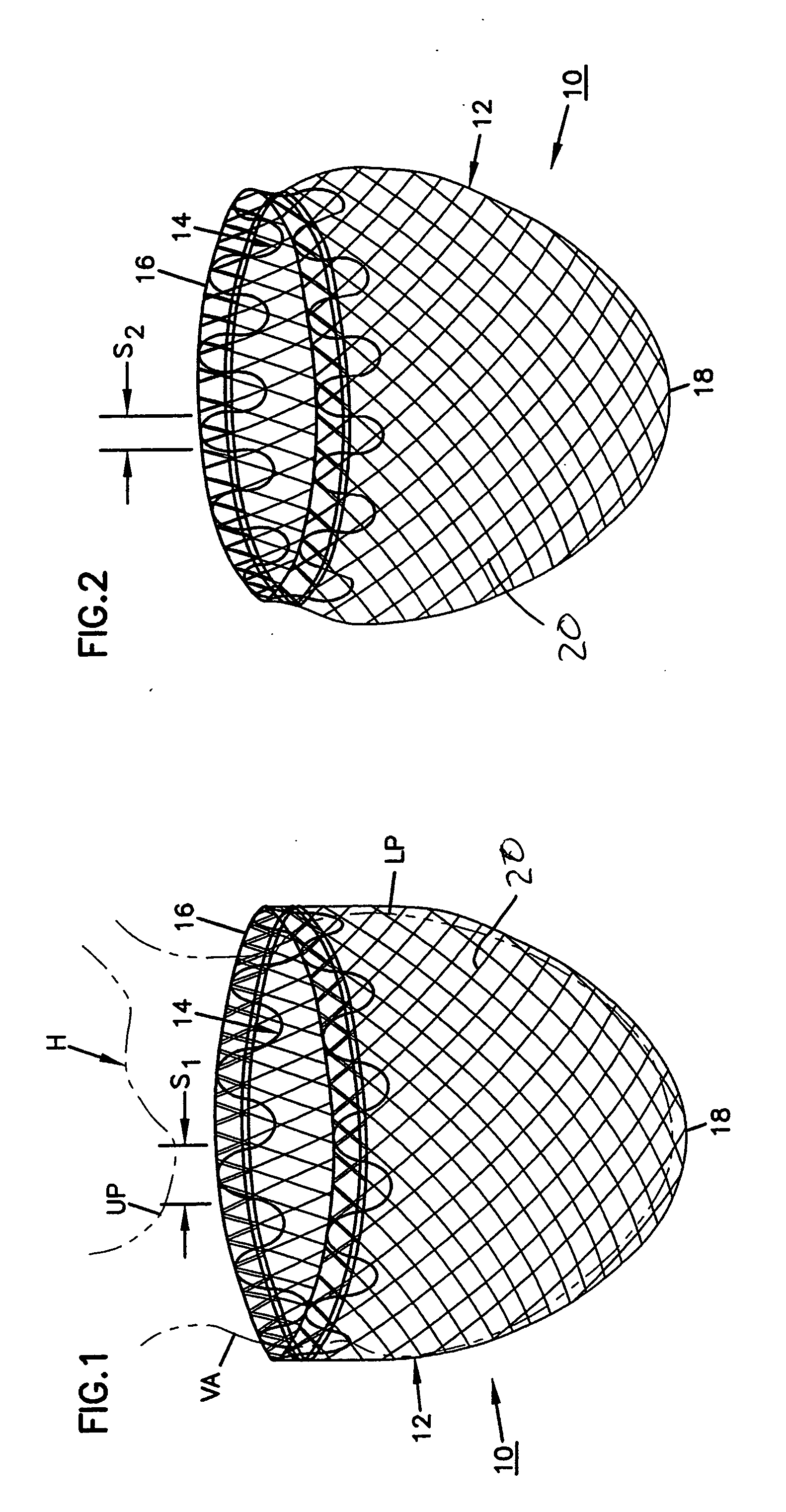 Self-adjusting securing structure for a cardiac support device