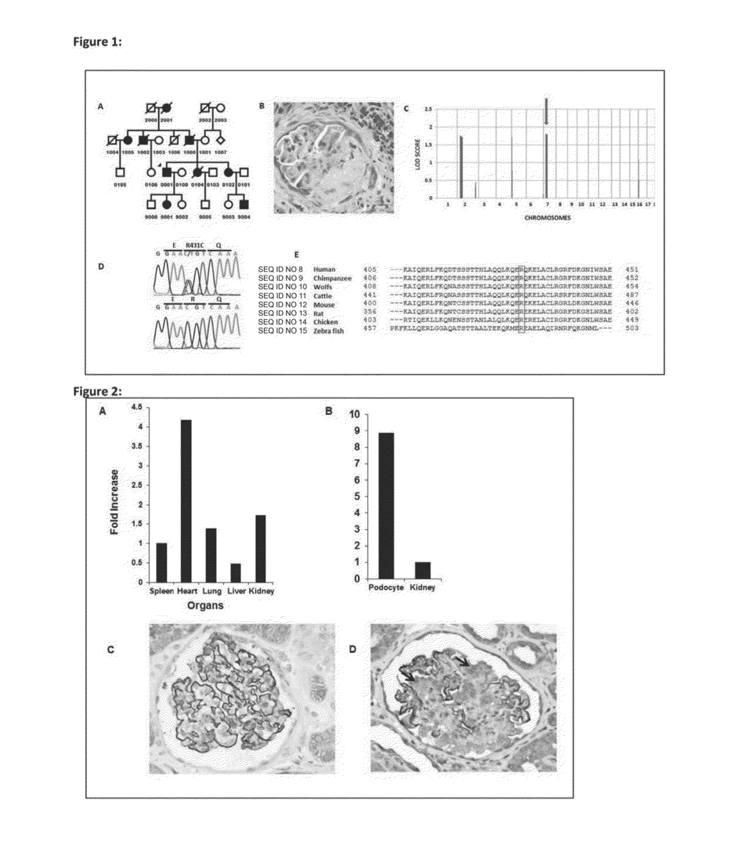 Novel genes causing hereditary kidney disease or malformation of the urinary tract