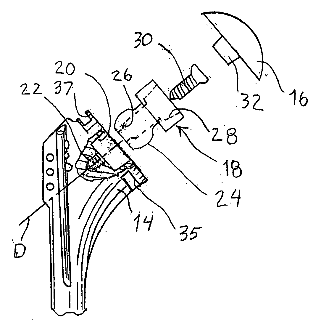 Instrumentation for recording and replicating orthopaedic implant orientation