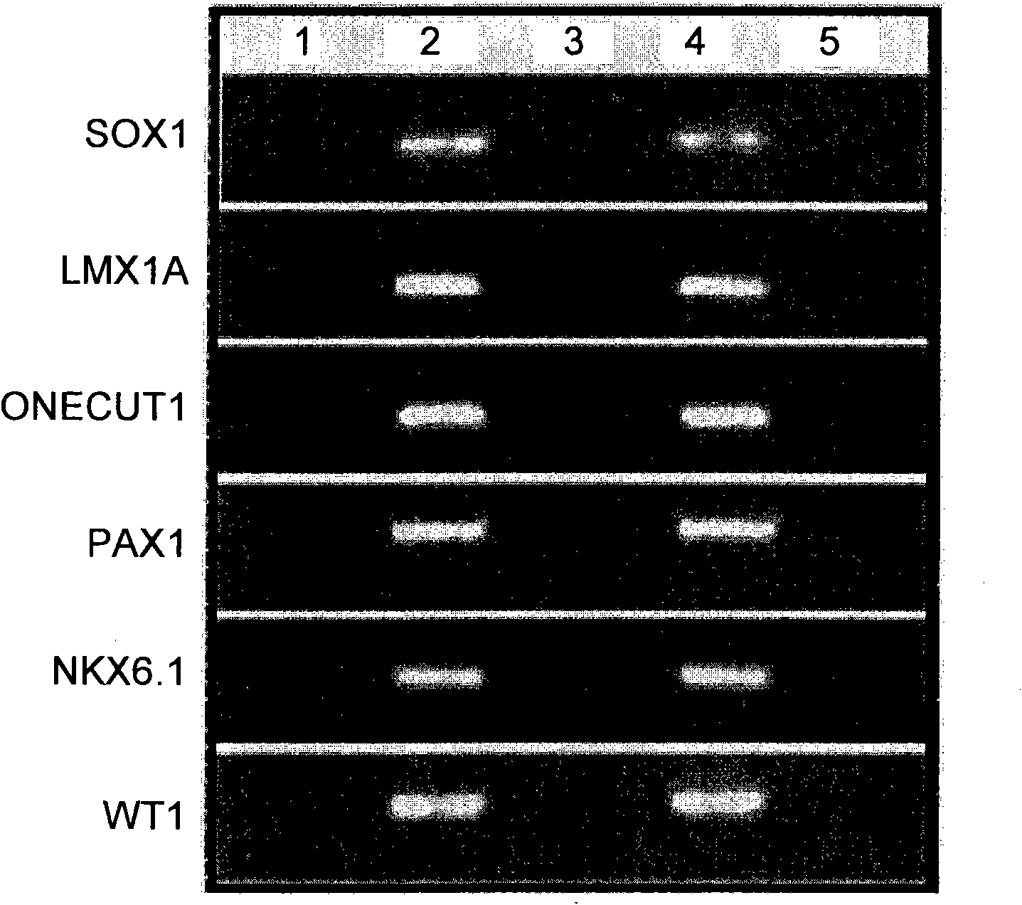 Sieving and checking method for cancers