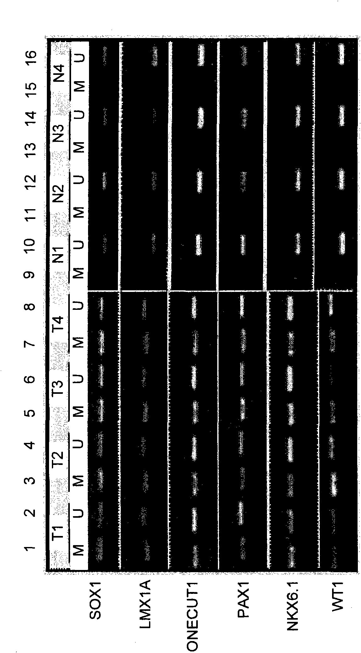 Sieving and checking method for cancers