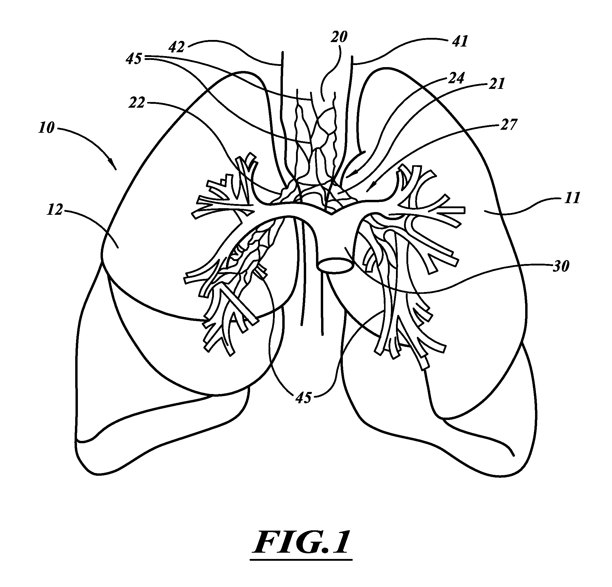 Compact delivery pulmonary treatment systems and methods for improving pulmonary function