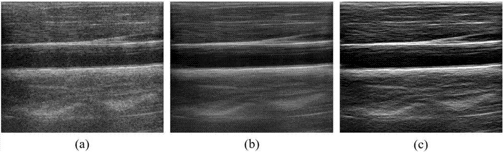 Ultrasonic image de-noising and enhancement method