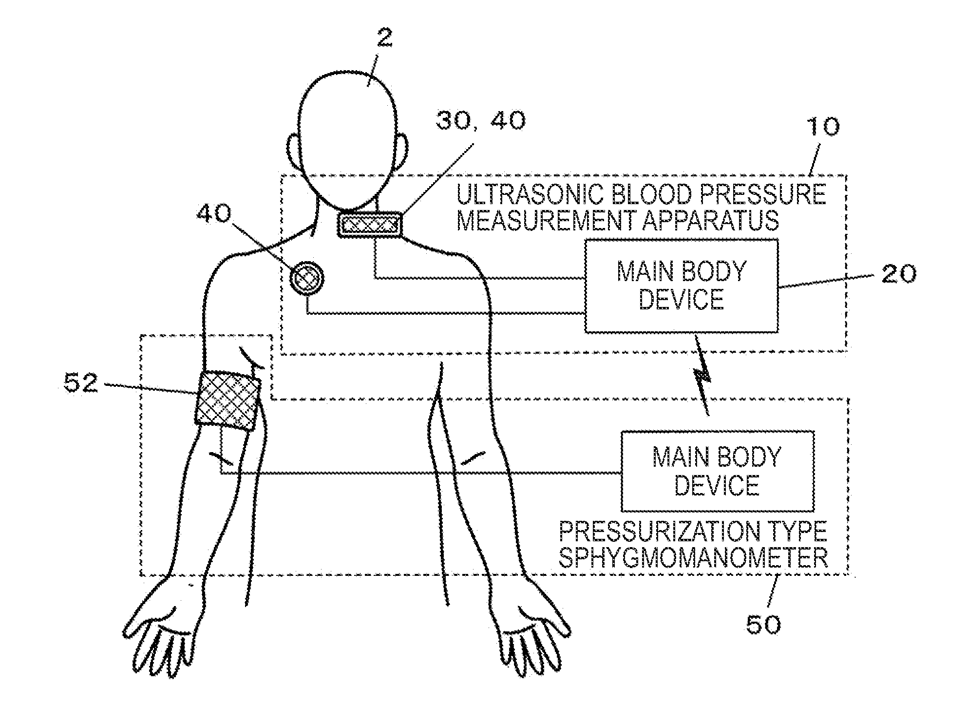 Ultrasonic blood pressure measurement apparatus and blood pressure measurement method