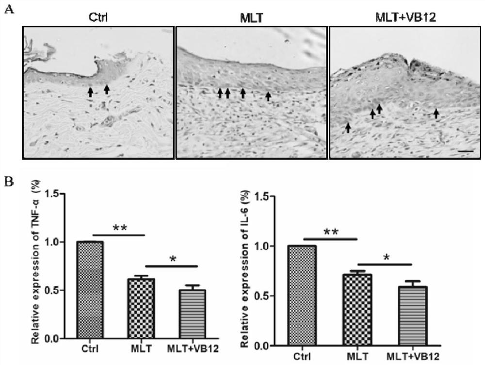 Application of melatonin combined with methylcobalamin in the treatment of diabetic wound healing disorder