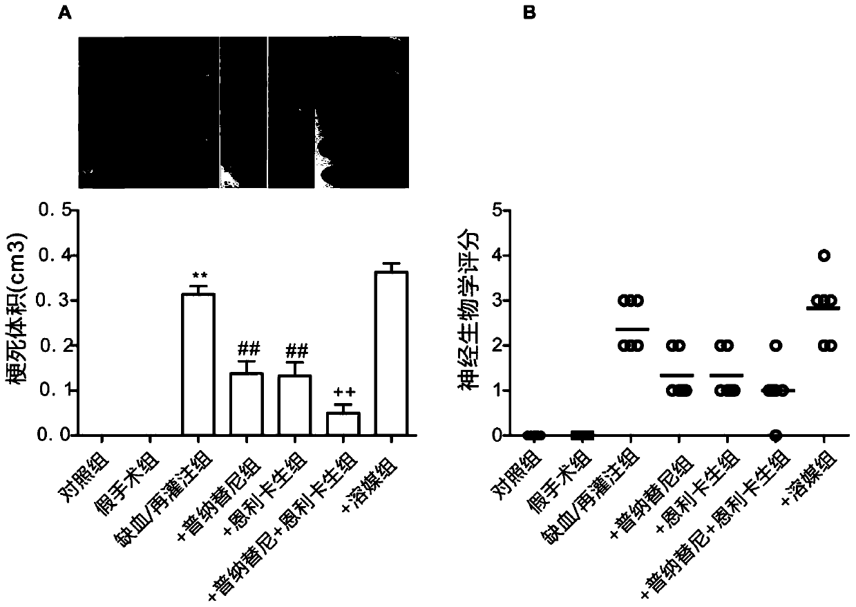 A kind of pharmaceutical composition and application for preventing or treating ischemia/reperfusion injury