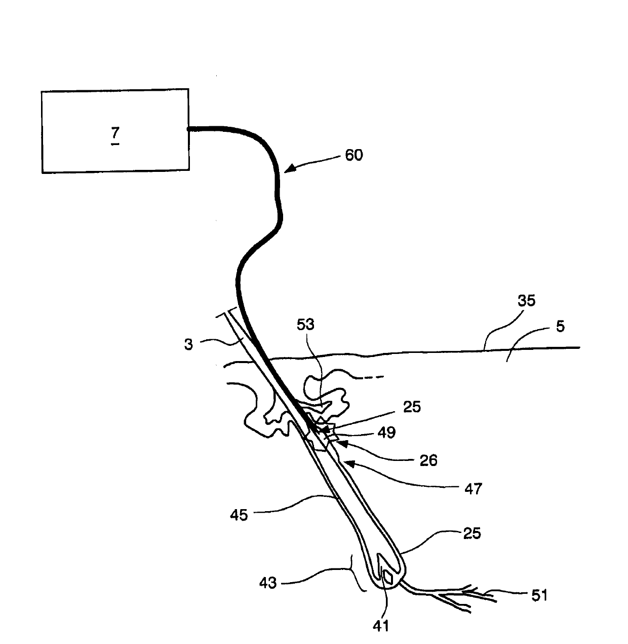 Hair-growth control device and hair-growth control method