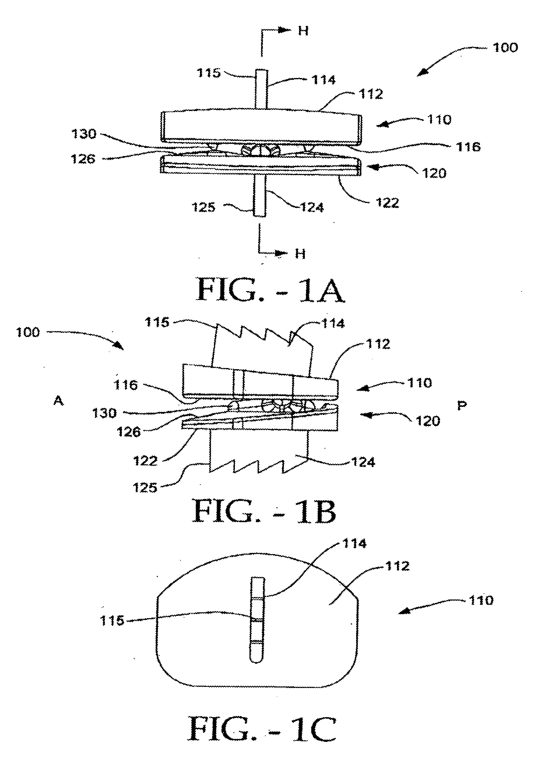 Artificial vertebral disk replacement implant with crossbar spacer and method