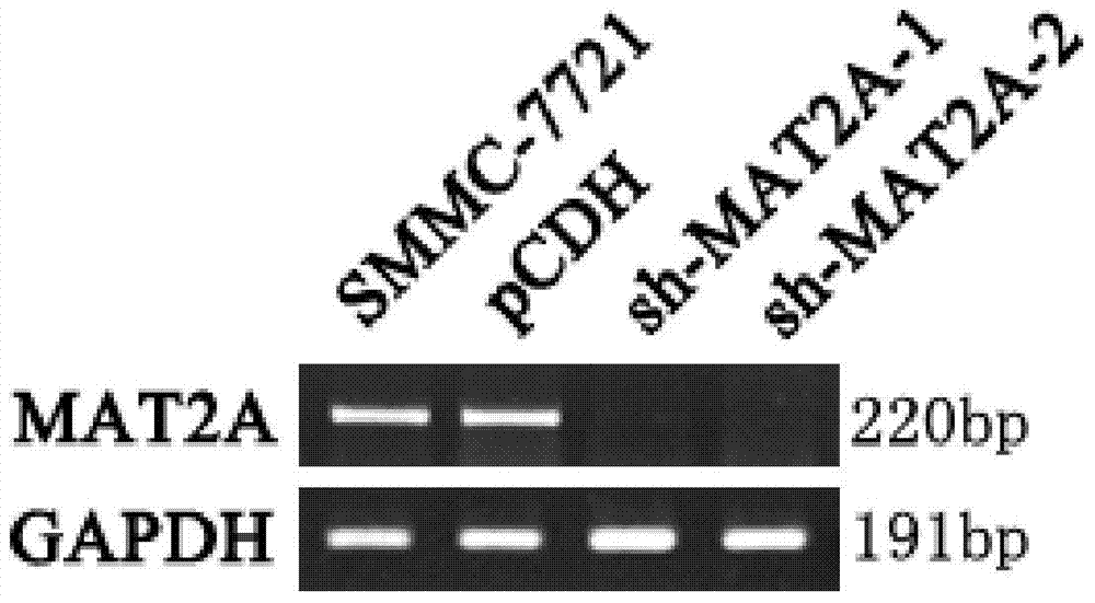 siRNA capable of inhibiting mat2a gene expression and its application