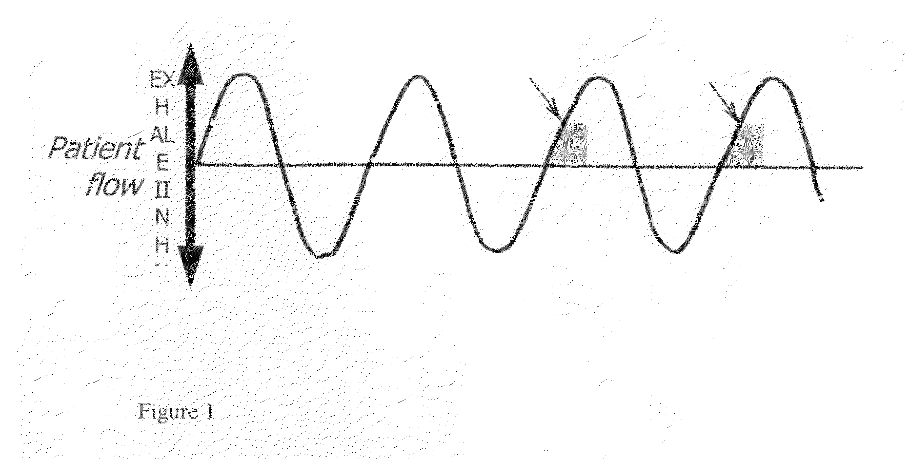 Method of treating tuberculosis with interferons