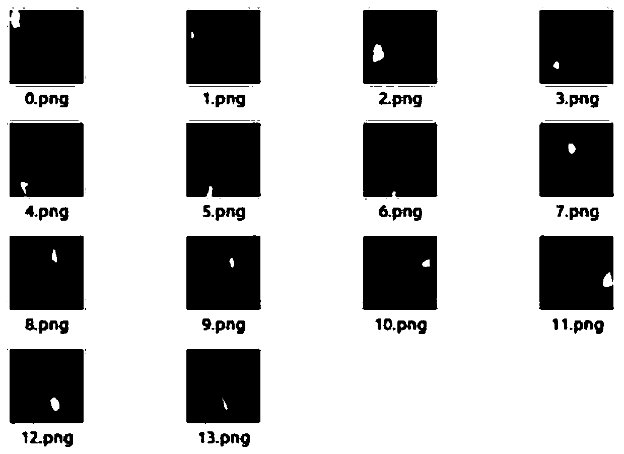 A Mask-RCNN-based cervical cell smear image segmentation method and system