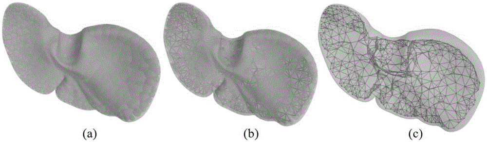 Metaball model based soft tissue deformation method