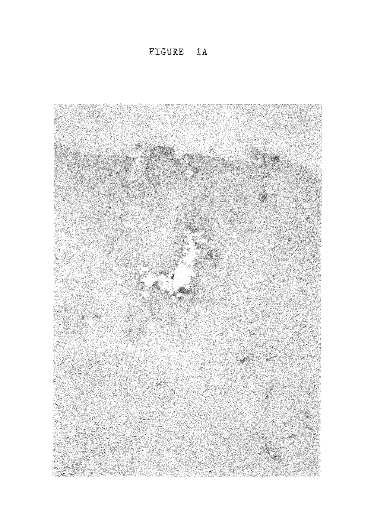 Formulations comprising antisense nucleotides to connexins