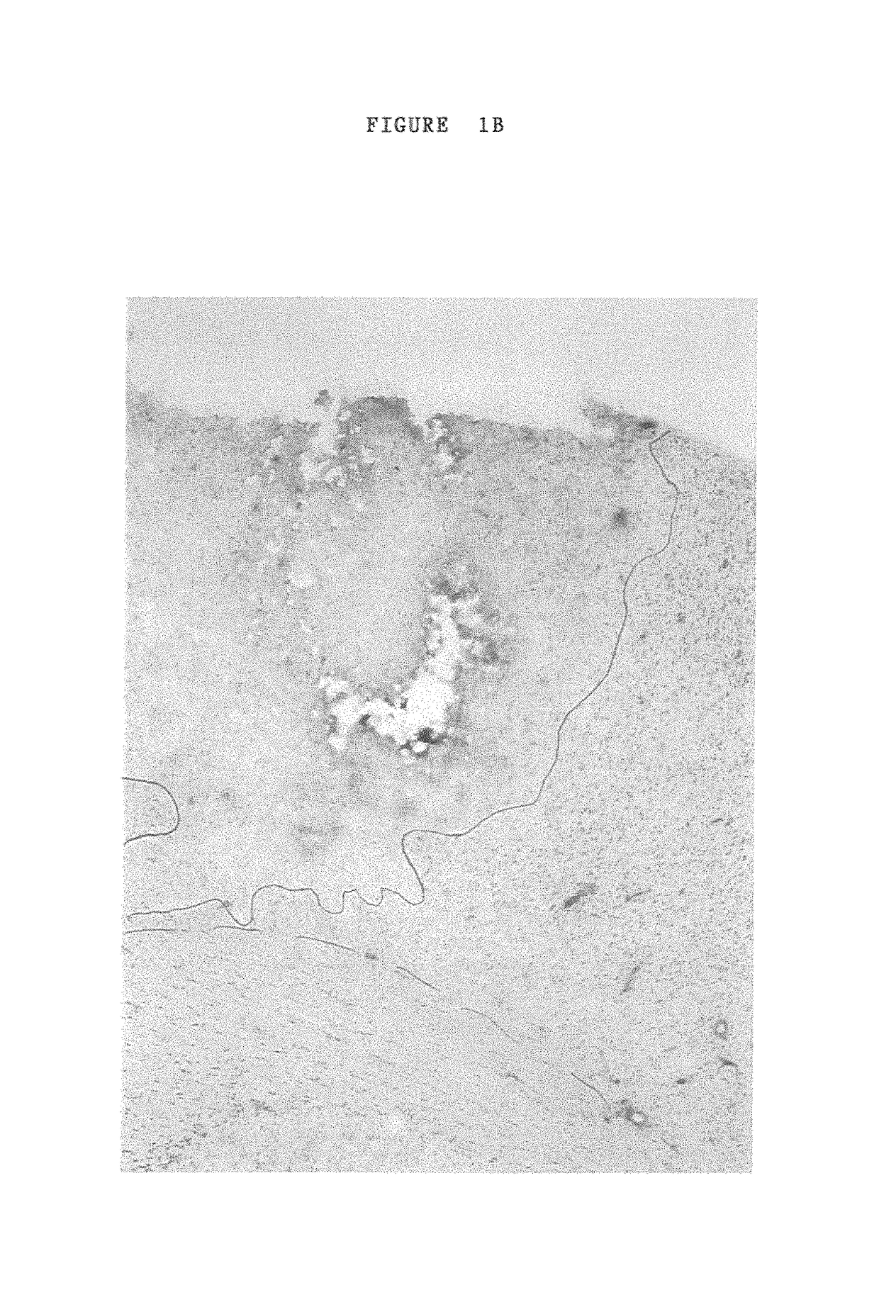 Formulations comprising antisense nucleotides to connexins