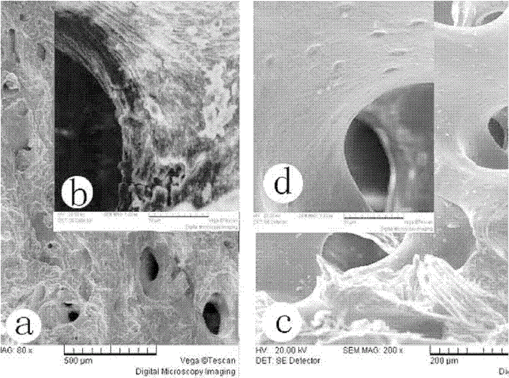 Acellular Bone Matrix Composite Material with Local Anticoagulation and Cell Capture and Preparation Method