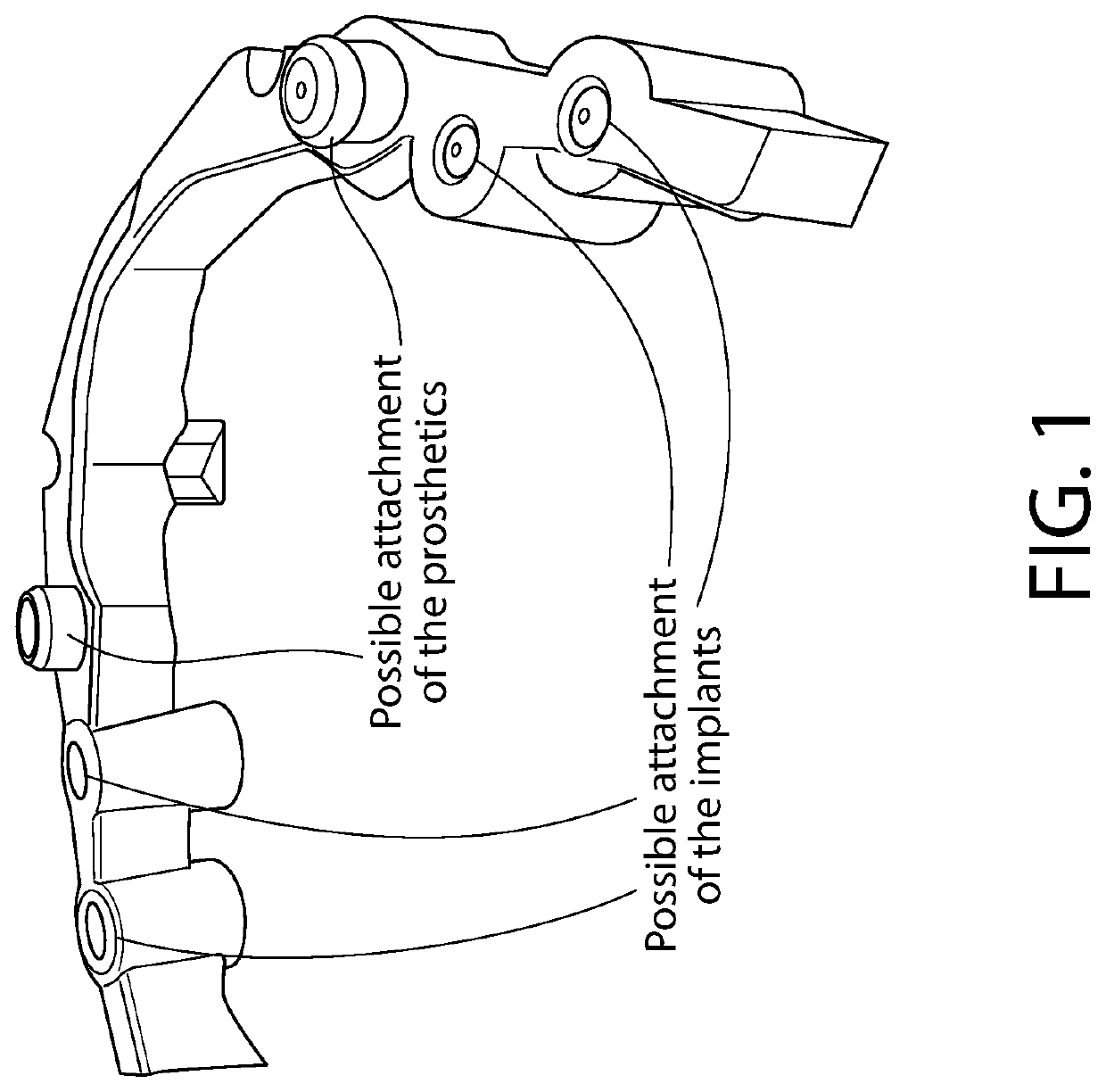 Optimization of superstructures and/or mesostructures in dental prostheses