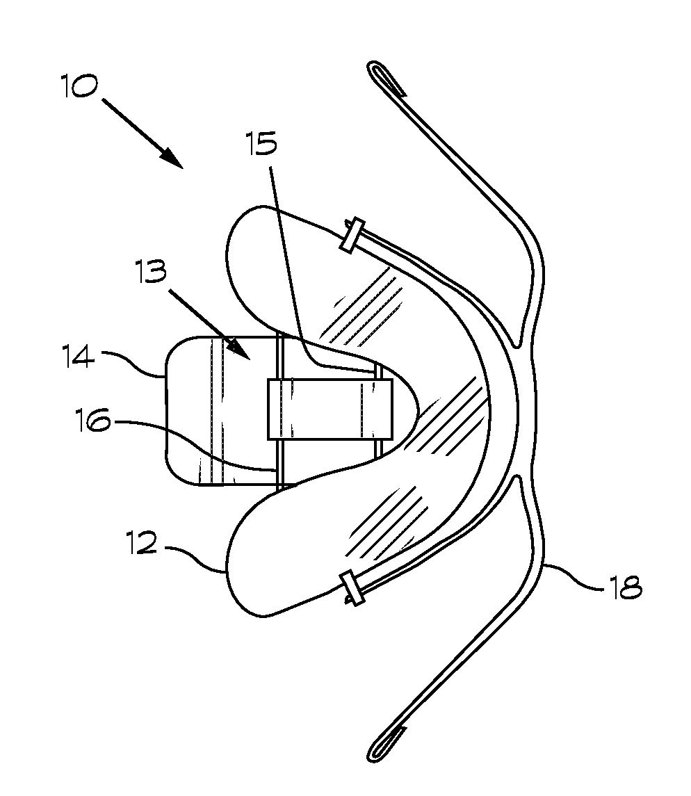 Snoring and sleep apnea prevention device