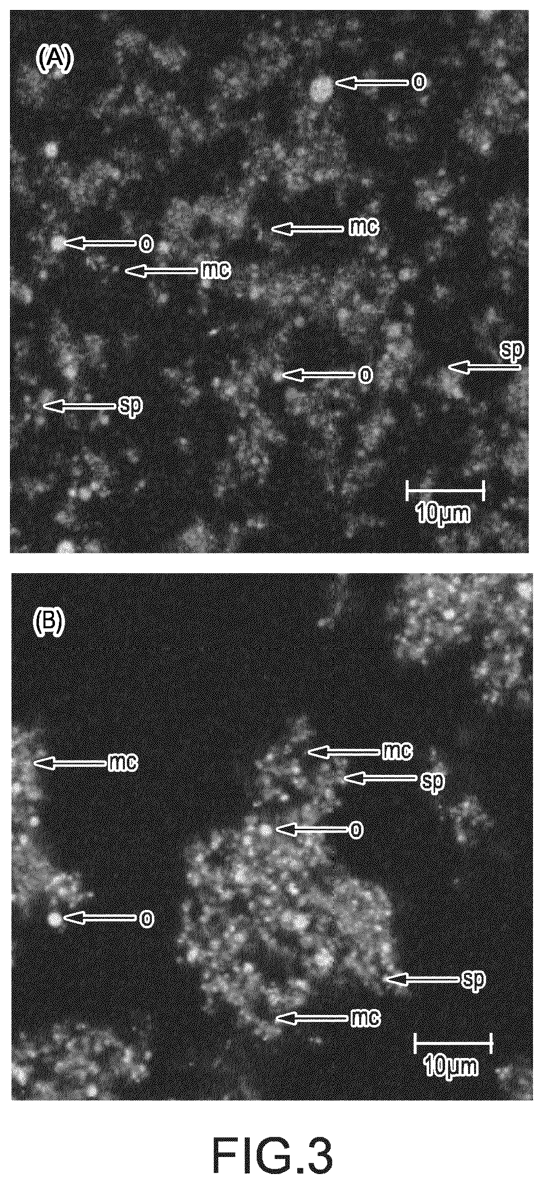 A method of producing a food or beverage product with free divalent cations dairy and plant protein aggregation