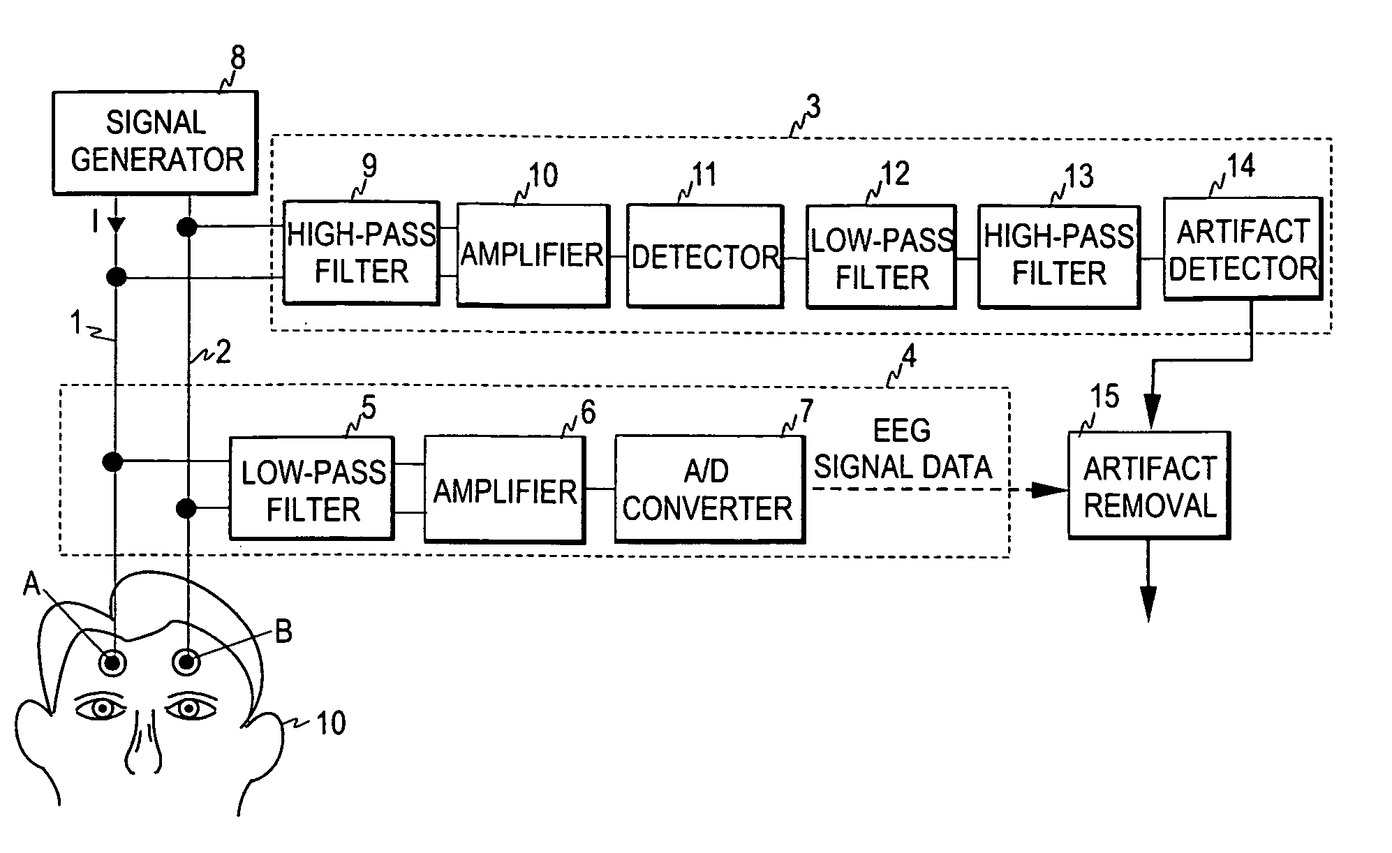 Detection of artifacts in bioelectric signals