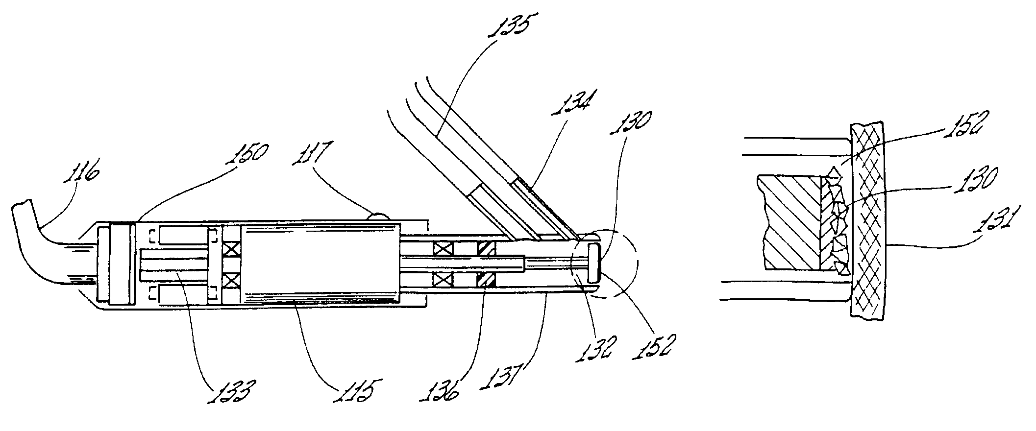 Microdermabrasion device