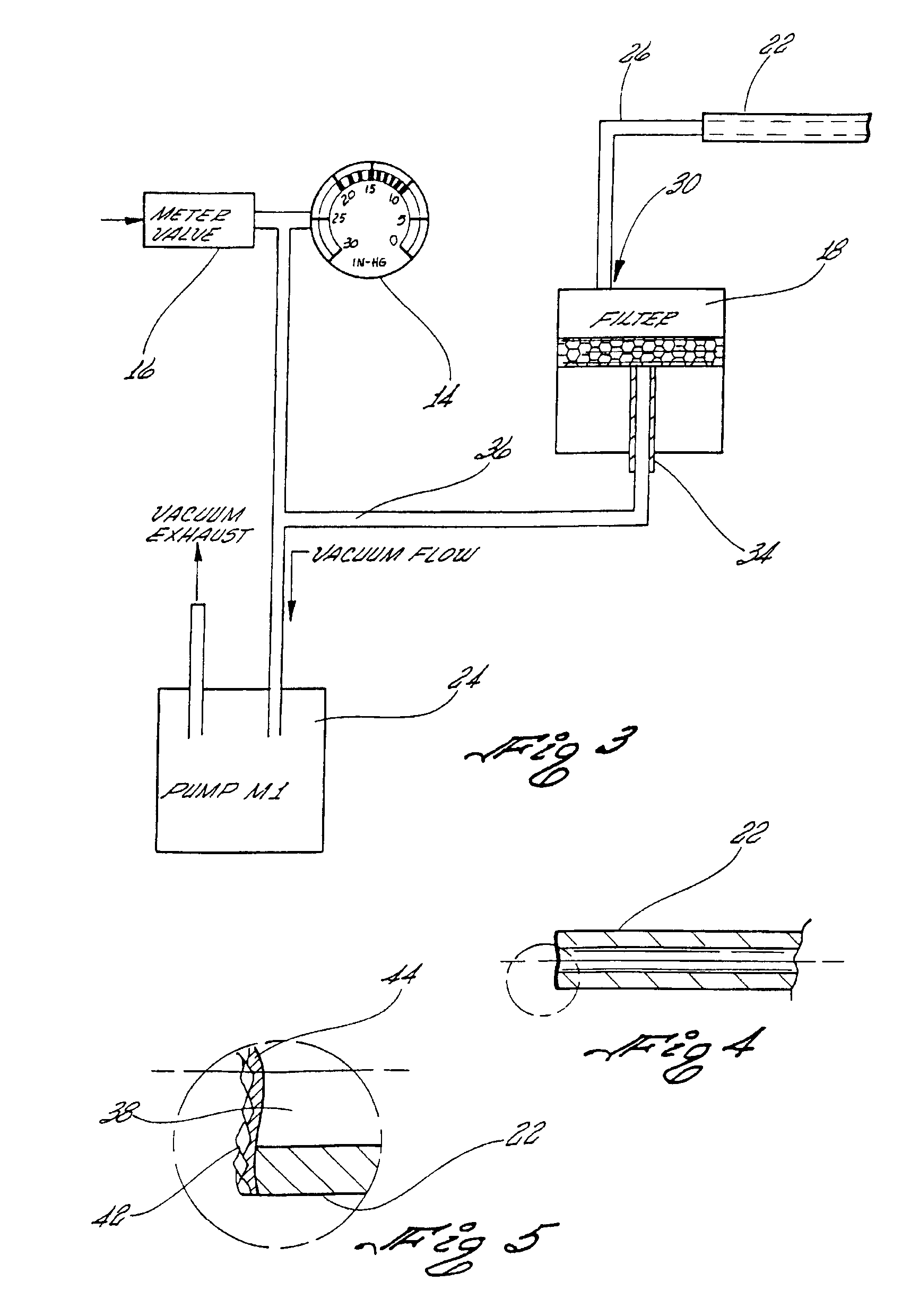 Microdermabrasion device