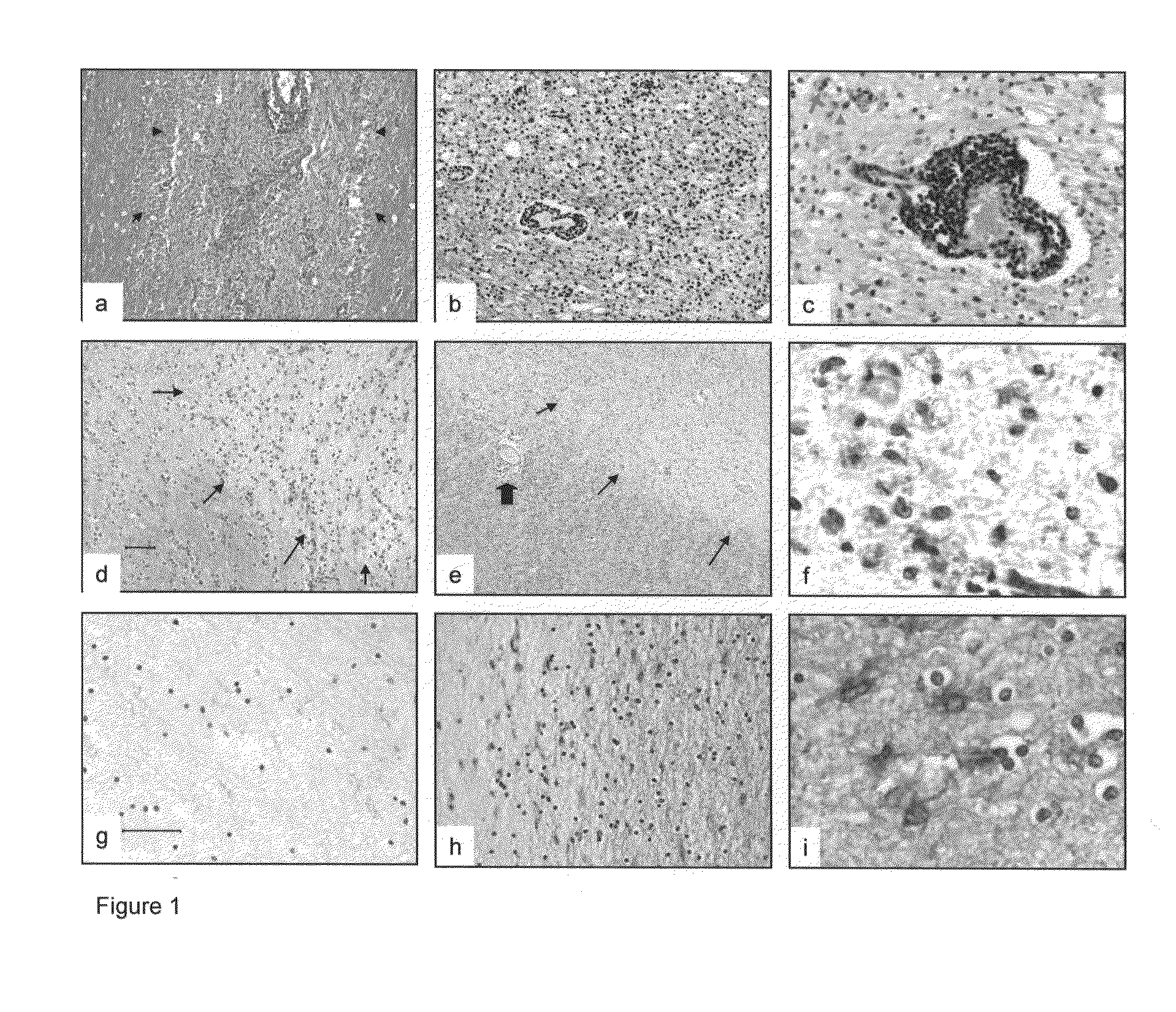 Proteomic analysis of active multiple sclerosis lesions