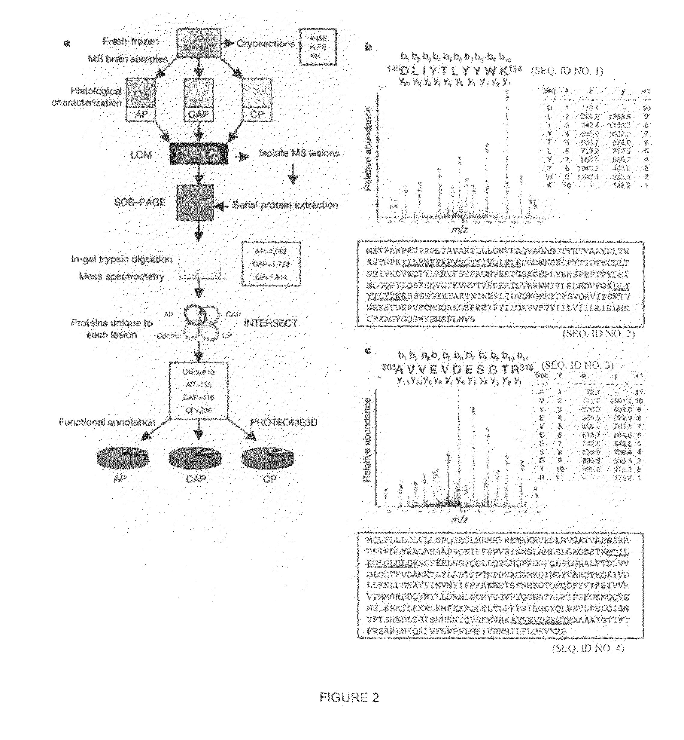 Proteomic analysis of active multiple sclerosis lesions