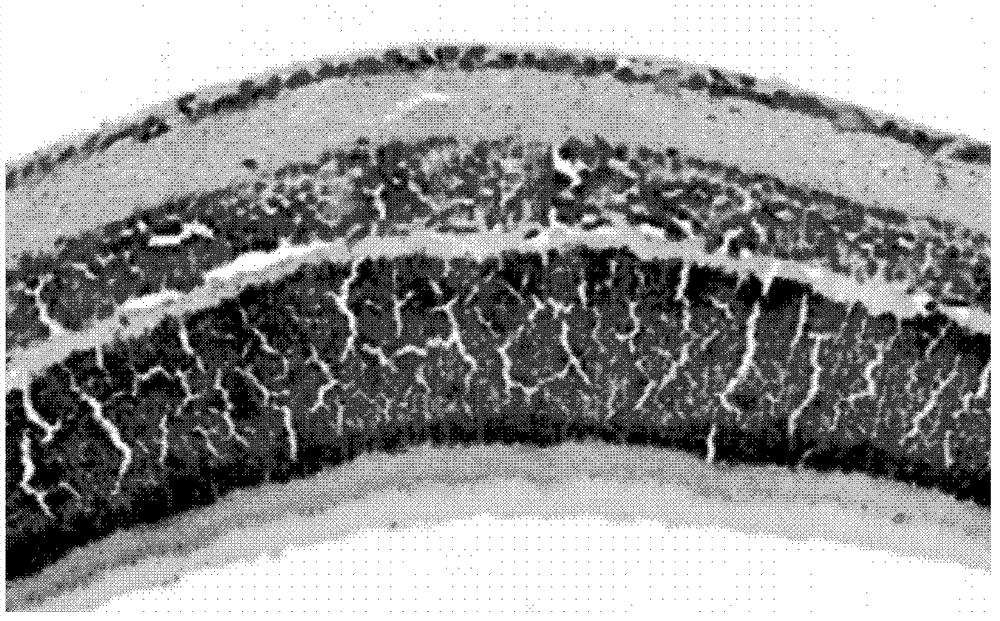 Application of drug composition in drug preparation for preventing or treating neovascular diseases