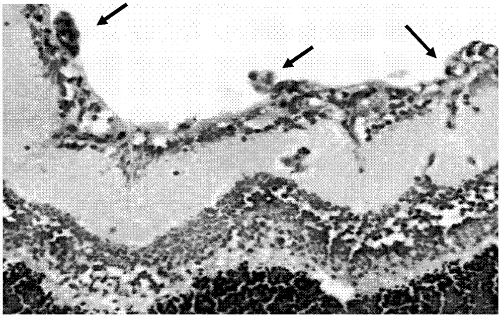 Application of drug composition in drug preparation for preventing or treating neovascular diseases