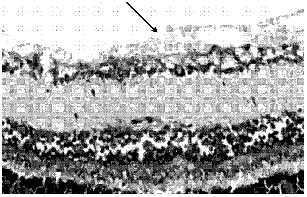 Application of drug composition in drug preparation for preventing or treating neovascular diseases