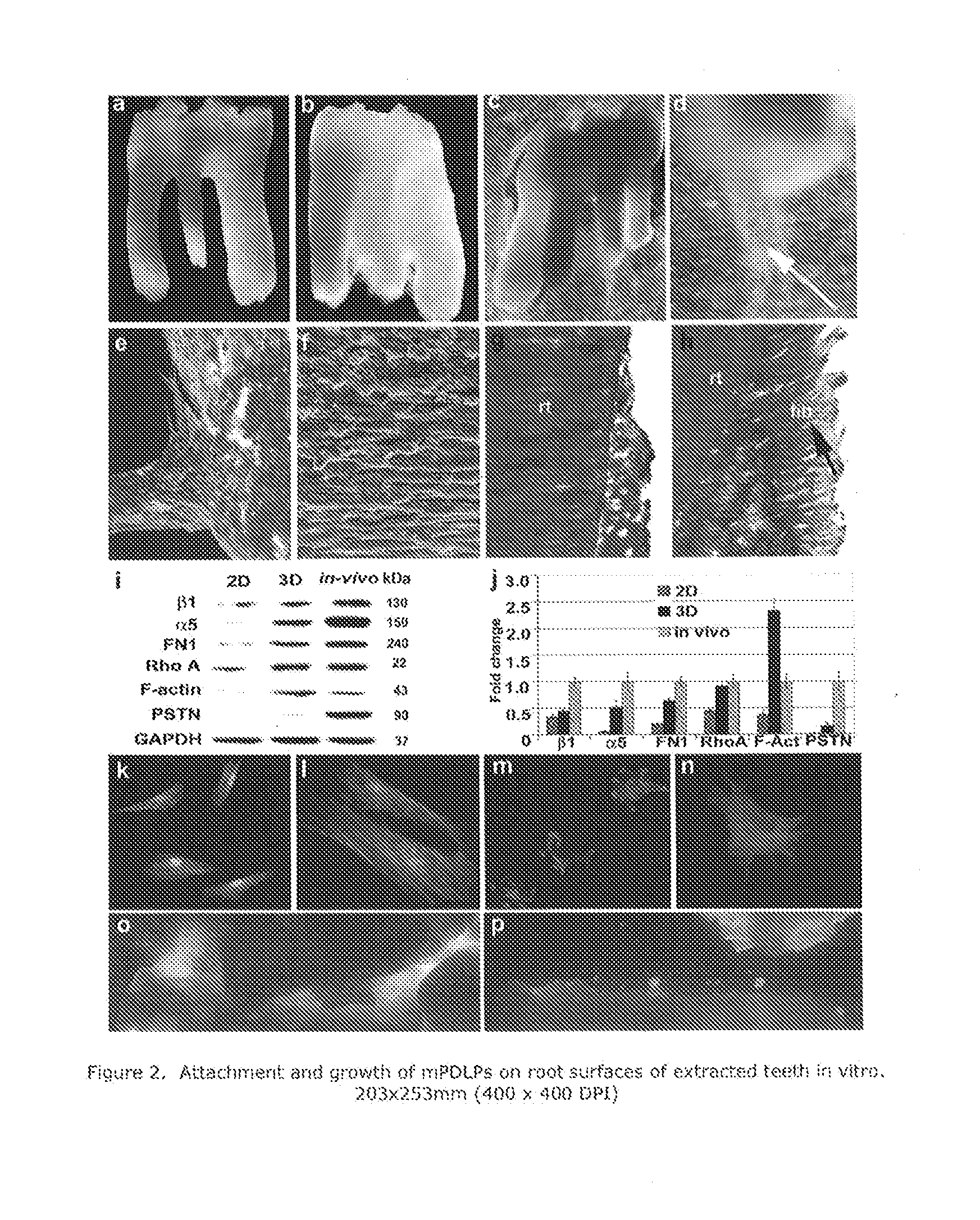 Reagents and methods for preparing teeth for implantation