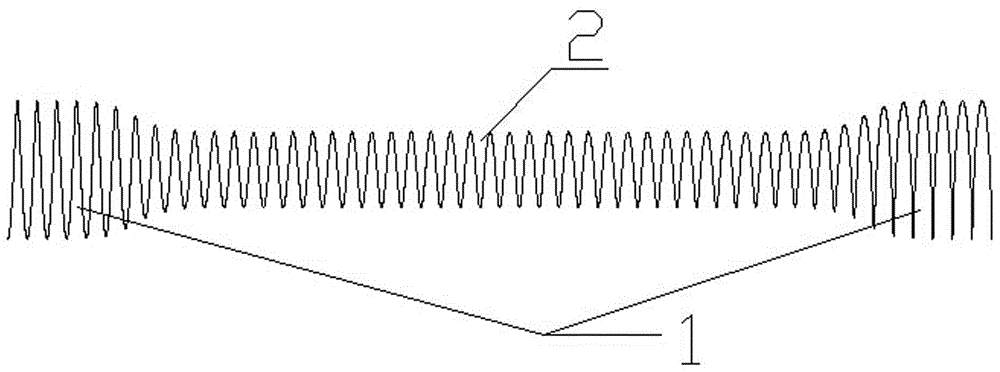 Novel biodegradable zinc-based metal material and ureteral expandable stent obtained through material