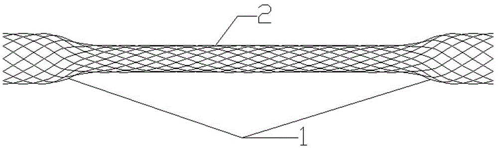 Novel biodegradable zinc-based metal material and ureteral expandable stent obtained through material