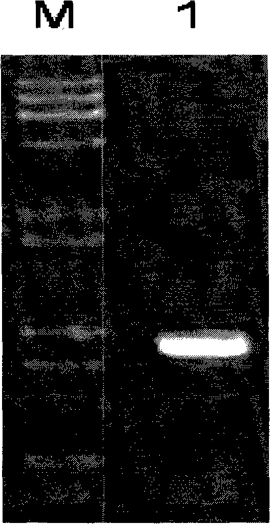 Comamonas testosterone engineering bacteria and use thereof